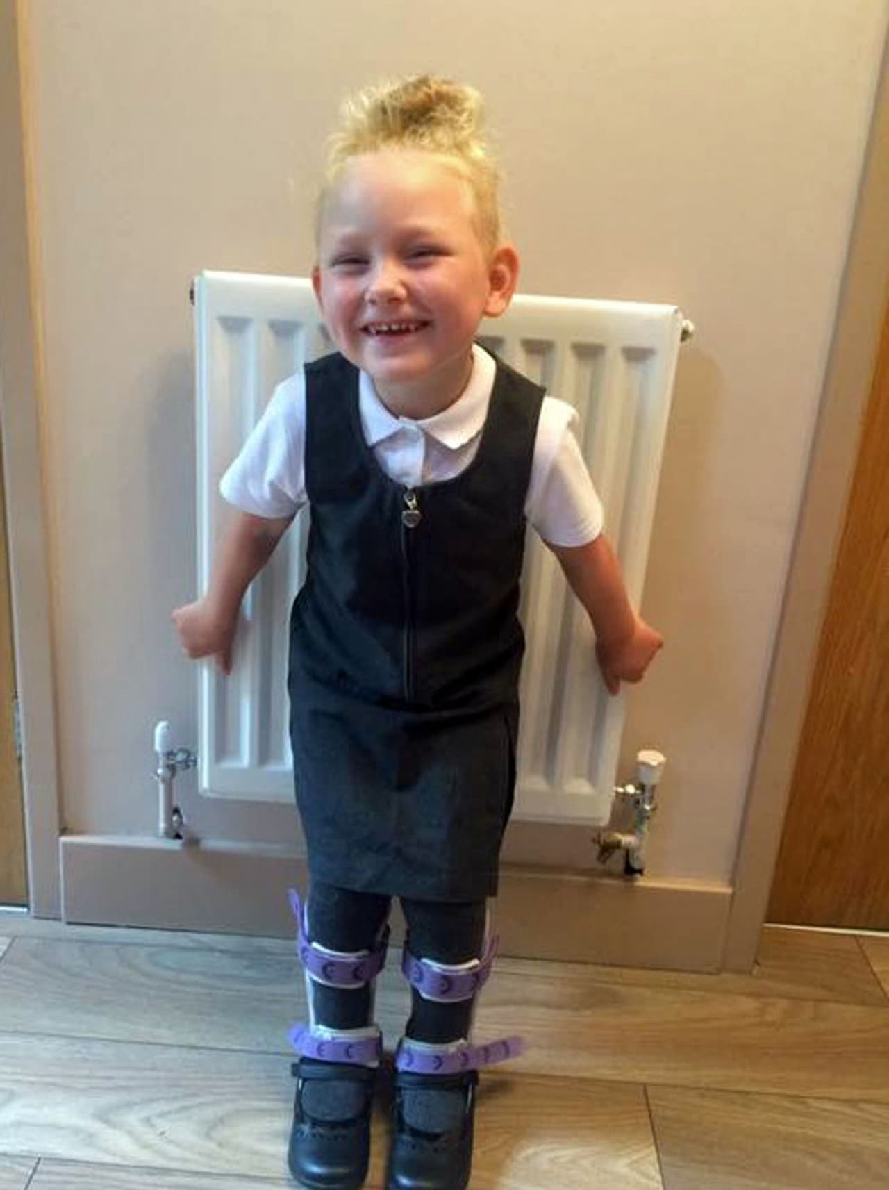 Las inyecciones de bótox le permiten un mejor control de sus movimientos y reduce los riesgos de un daño en los tendones y músculos.