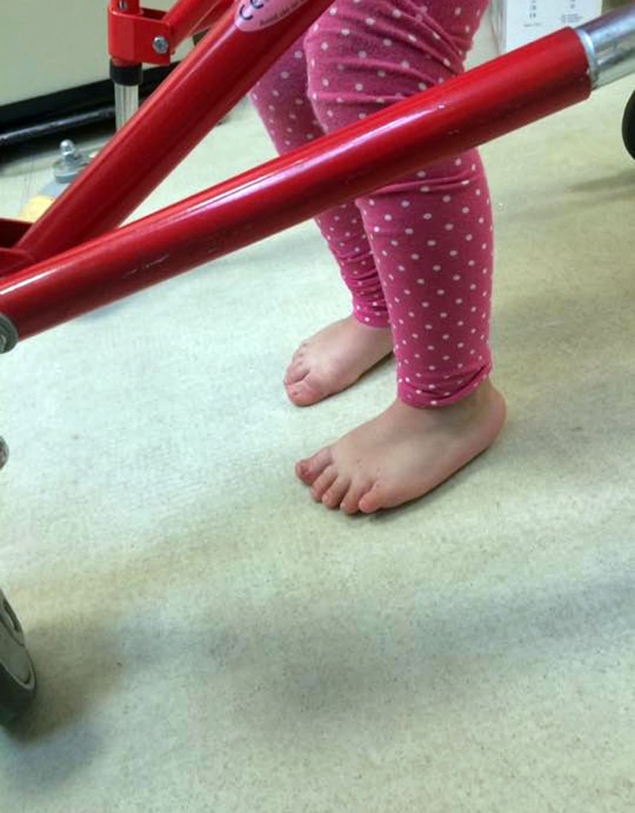 Aunque todavía necesita ayuda para caminar, ella puede subir las escaleras y moverse.