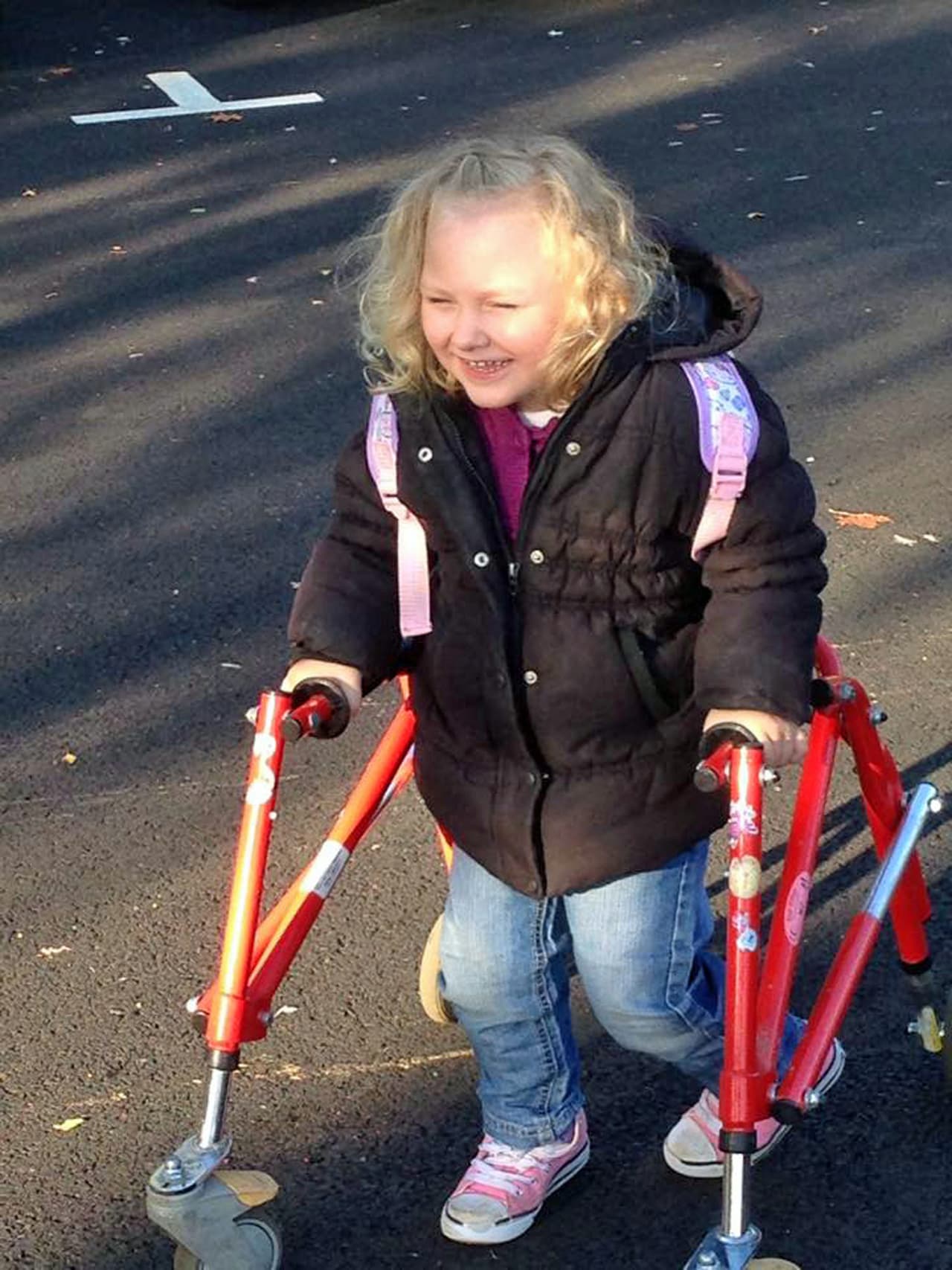 Esta condición le impide pararse pues las plantas de sus pies son débiles.