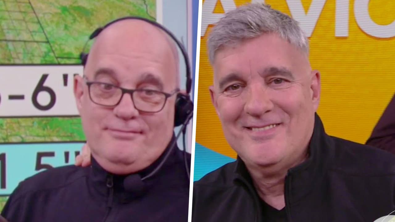 Adiós a la calvicie: transformamos con un reemplazo de cabello a nuestros compañeros de Despierta América