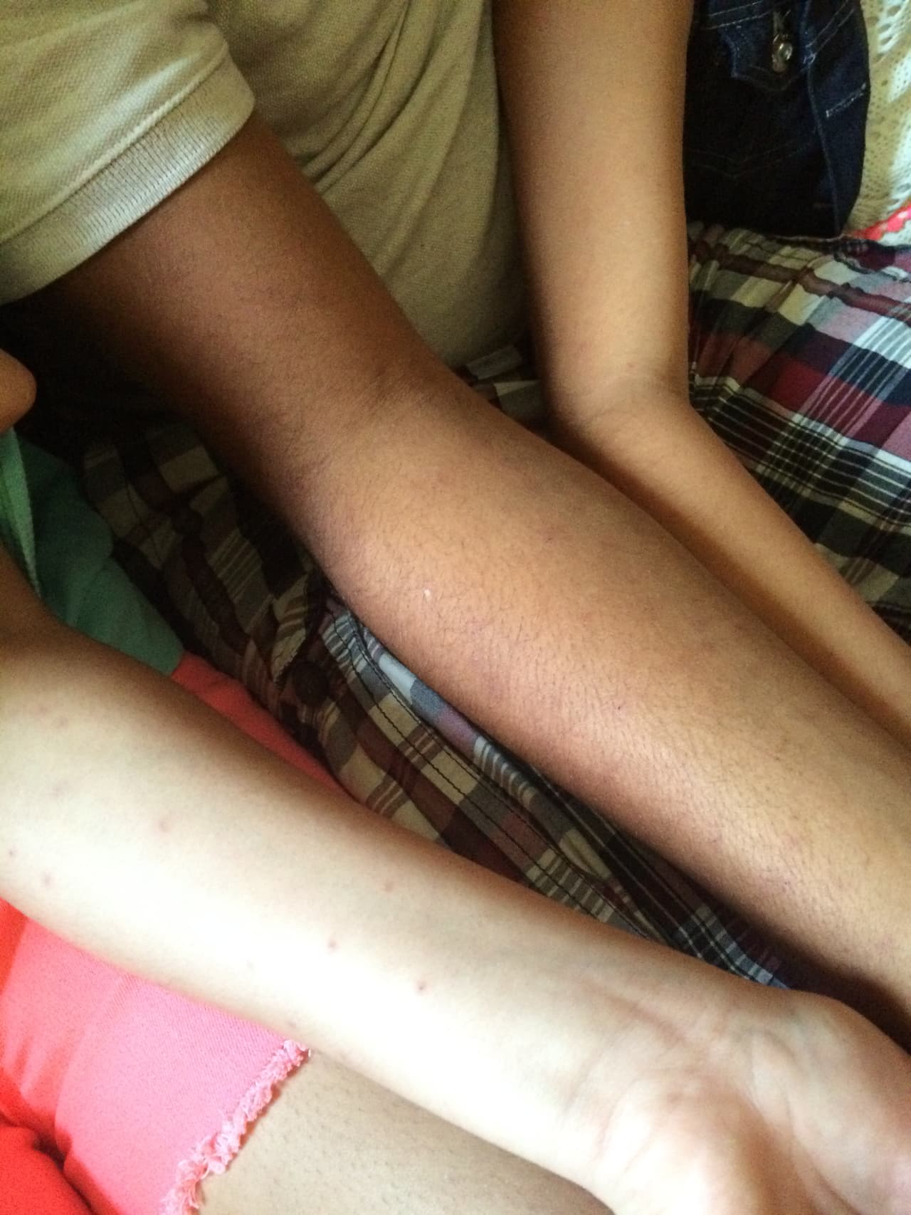 Las erupciones duran más de una semana.