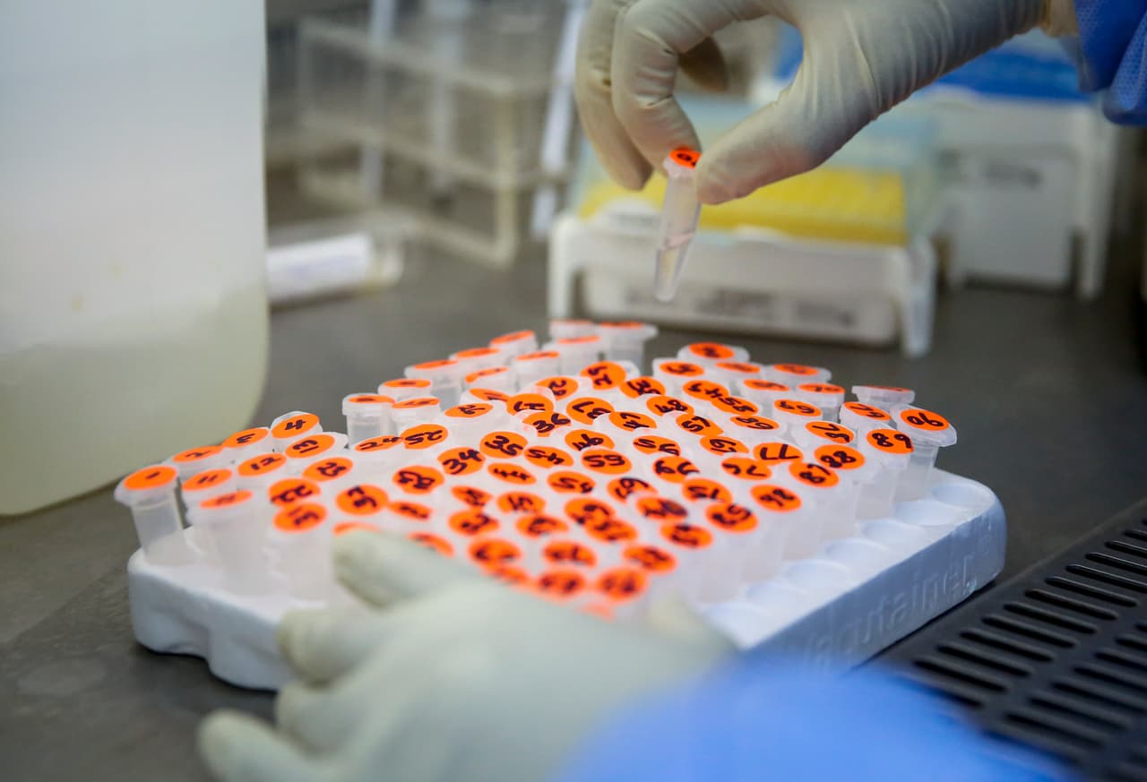 ¿Son los alimentos grasos un arma contra el coronavirus? Un grupo de científicos cree que sí