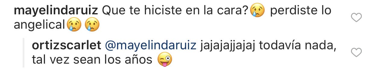 Ante las dudas, Scarlet contestó así para negar que haya recurrido al bisturí.