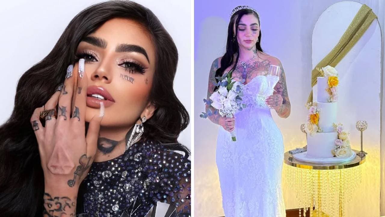 Muere 'influencer' tras someterse a procedimiento estético en medio de su luna de miel