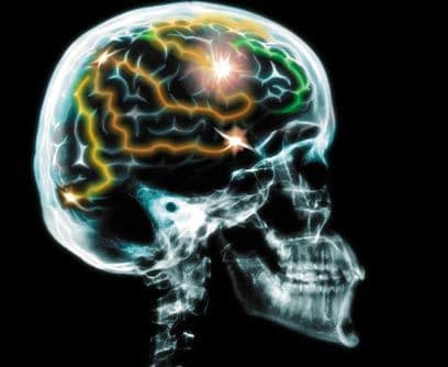 Cirujano de aumento de memoria Entramos a la era del todo se puede. Ahora es muy fácil incrementar la memoria de nuestras computadoras, ¿será posible en diez años más, aumentar la memoria humana? Con ayuda de la nanomedicina se espera que médicos e ingenieros formen un nuevo concepto de cirugía que será capaz de esto y mucho más.Fecha prevista: 2030Posibles estudios: medicina, ingeniería informática, biomedicina, biotecnología