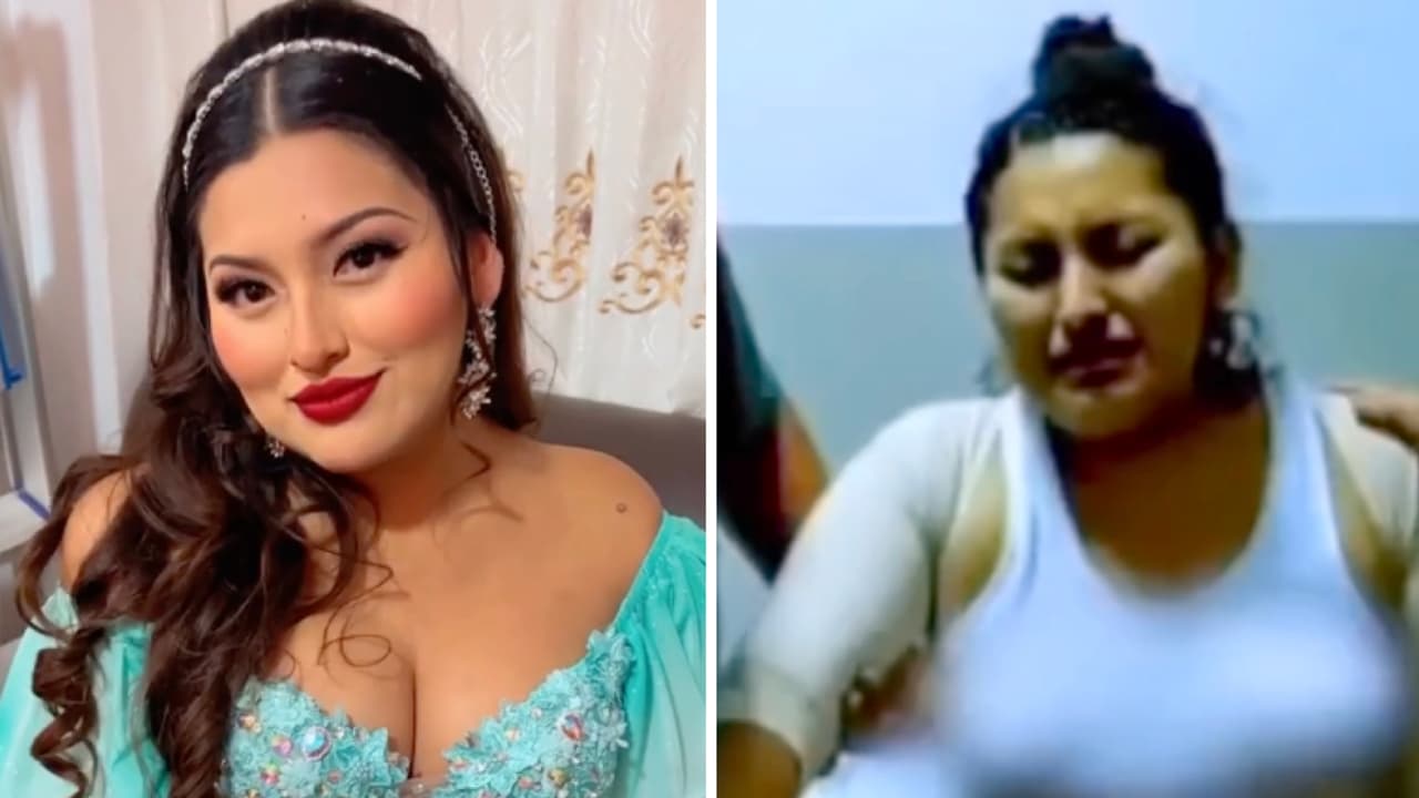 Difunden supuesto último video de Muñequita Milly tras su fatal cirugía estética: “Ya no puedo”