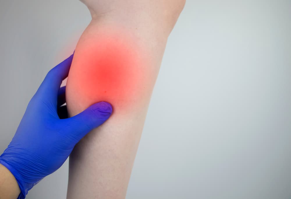 Mucho cuidado a la hora de caminar para evitar resbalones o tropiezos que pueden ocurrir con precipitaciones.