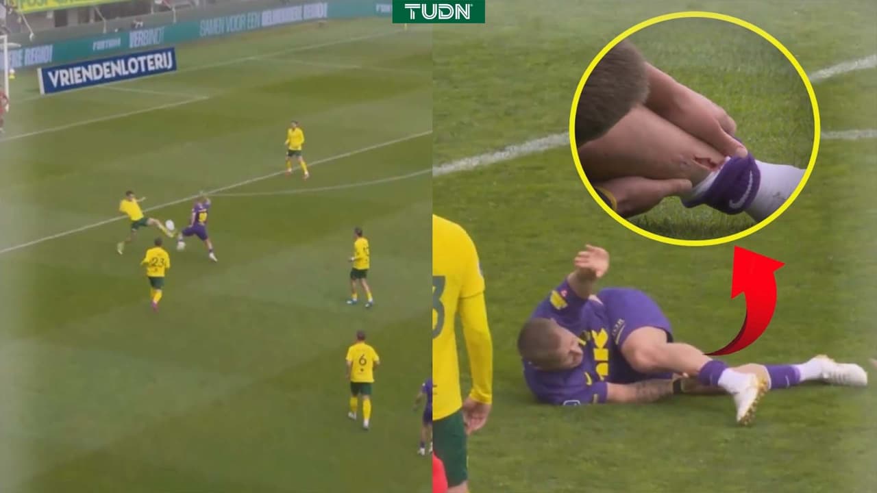 ¡Escalofriante! Holtby sale lesionado con tremenda herida