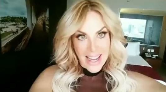 Sin embargo, Lorena Herrea fue tajante y directa al asegurar que a sus 52 años de edad, solo se ha hecho cirugía en los labios.