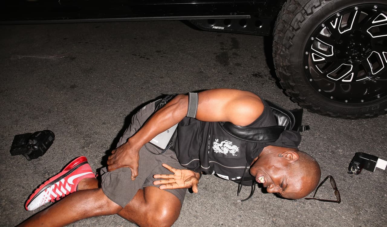 El paparazzi adolorido preguntaba por su equipo, que quedó parcialmente destruido en el accidente.