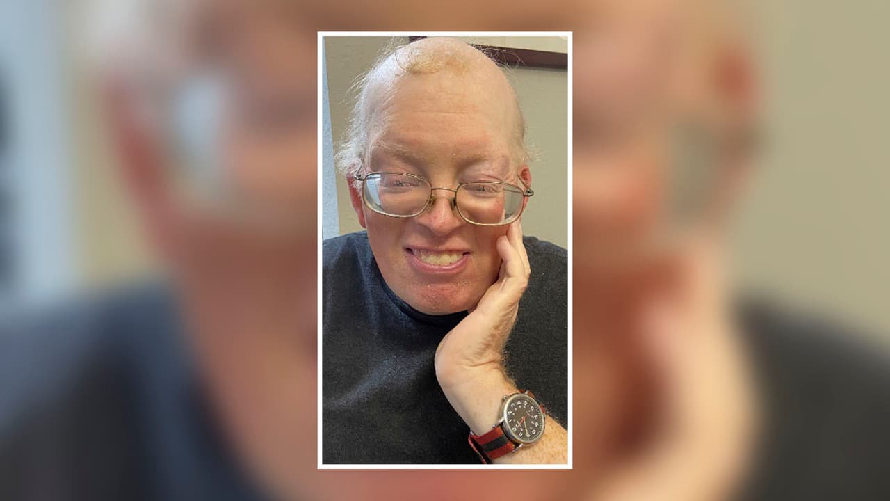 De acuerdo con la demanda, Brown, quien tenía 46 años, padecía de varias condiciones de salud como un trastorno de deficiencia cromosómica, retraso en el desarrollo y trastorno por déficit de atención e hiperactividad (ADHD, por sus siglas en inglés). También tenía una discapacidad intelectual leve y visión borrosa, pero "con la ayuda de sus cariñosos entrenadores de vida y su apoyo familiar, pudo conseguir un empleo remunerado y vivir de forma independiente".