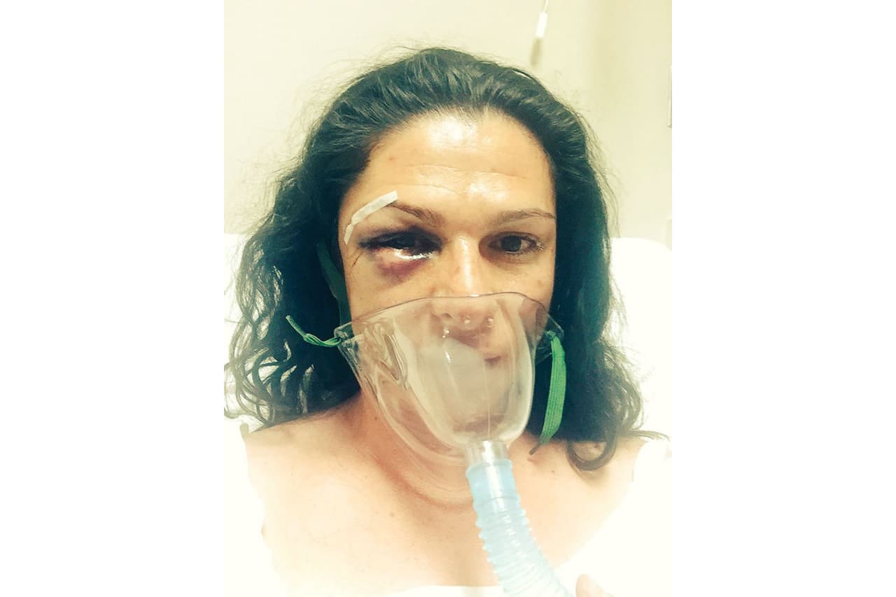 Cuarto hombres golpearon a la medallista olímpica mexicana Ana Gabriela Guevara en diciembre de 2016 "por ser mujer" después de un accidente de automóvil.