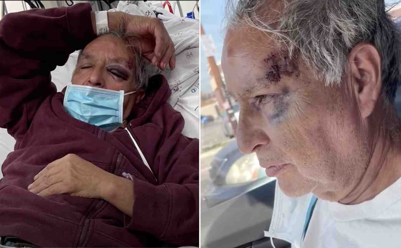 “Lo golpearon para matarlo”: hispano es atacado sin motivo aparente cerca de una tienda en Baldwin Park