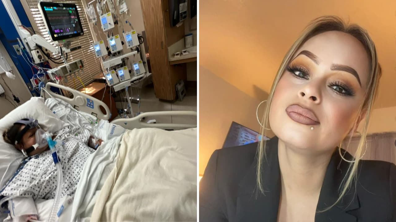 Mujer mexicana pierde extremidades: sospechan que comió tilapia poco cocida