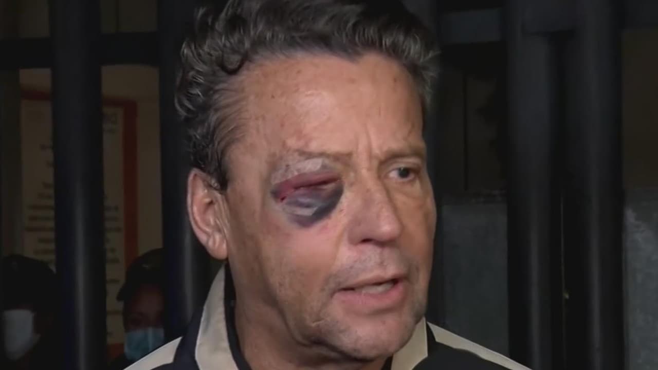 "Cuatro fracturas y cirugía": Alfredo Adame hace el recuento de los daños tras ser golpeado afuera de su casa