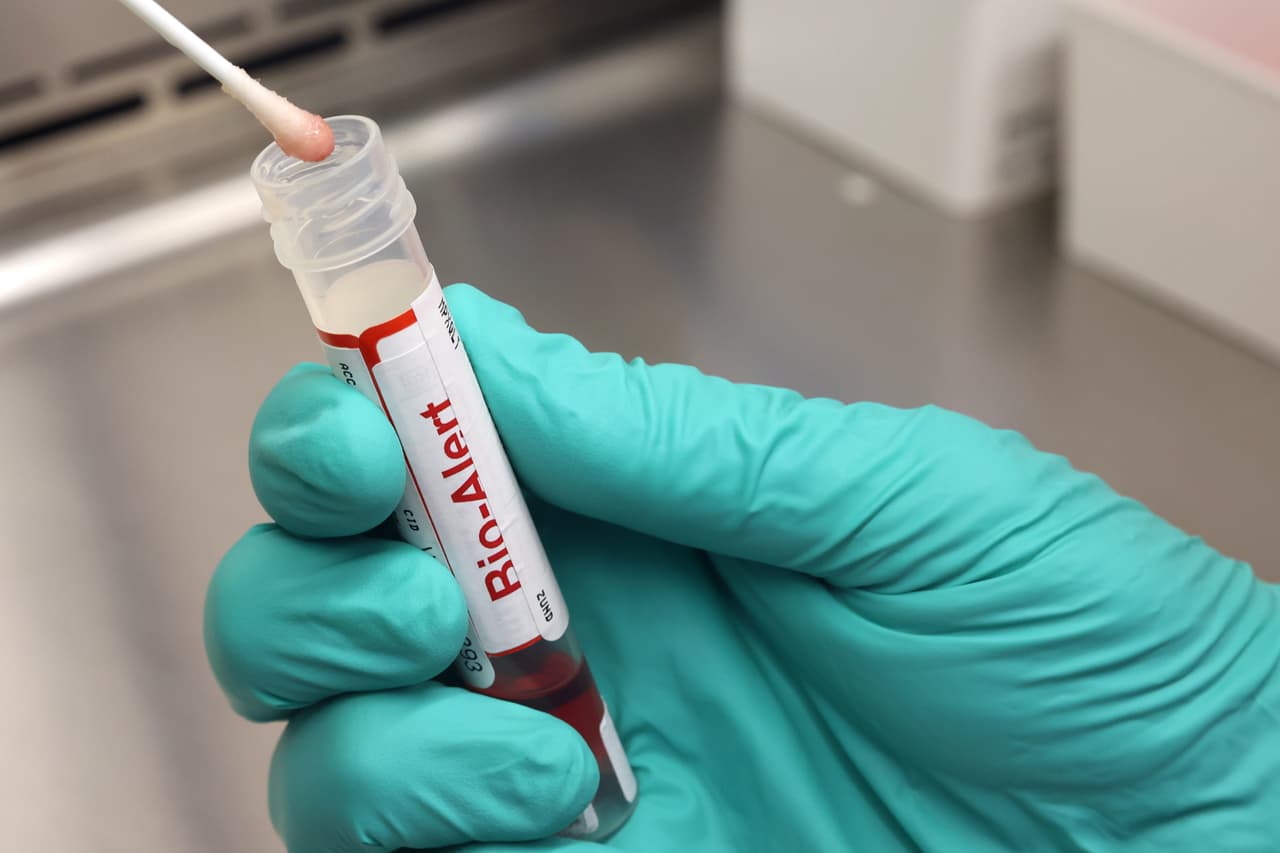 Los expertos médicos han asegurado que la gran mayoría de los casos son leves.