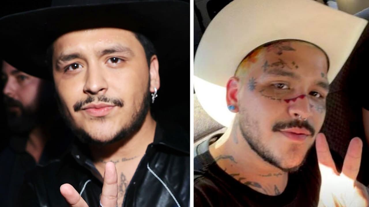 Así ha cambiado Nodal con el doloroso procedimiento para quitarse los tatuajes de la cara