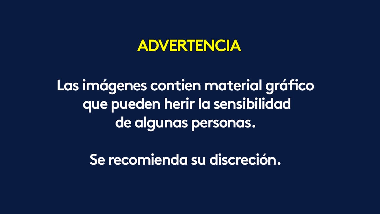 Las imágenes que a continuación verá pueden herir la sensibilidad de algunas personas. Se recomienda su discreción.