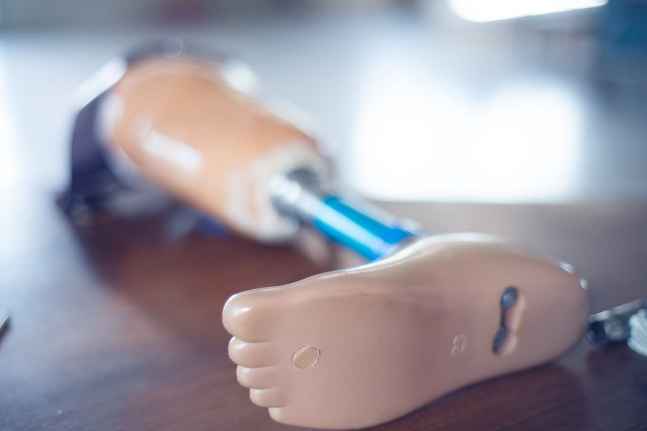 Un niño rifa un pollo que le había regalado su mamá para pagar una prótesis para su pierna