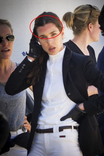 Y uno que otro golpecito en la cabeza.