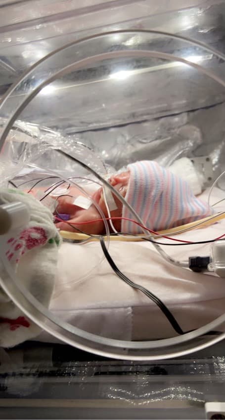 Santiago García nació con 26 semanas el 28 de mayo de 2021 y pesó sólo 2 libras.