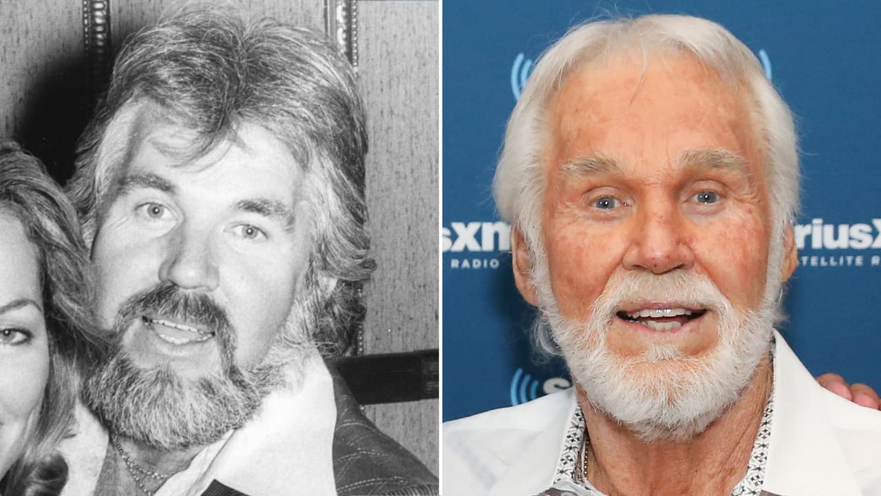 El cantante de música country, Kenny Rogers, quedó prácticamente irreconocible luego de pasar por el bisturí, viéndose el cambio más drástico en sus ojos.