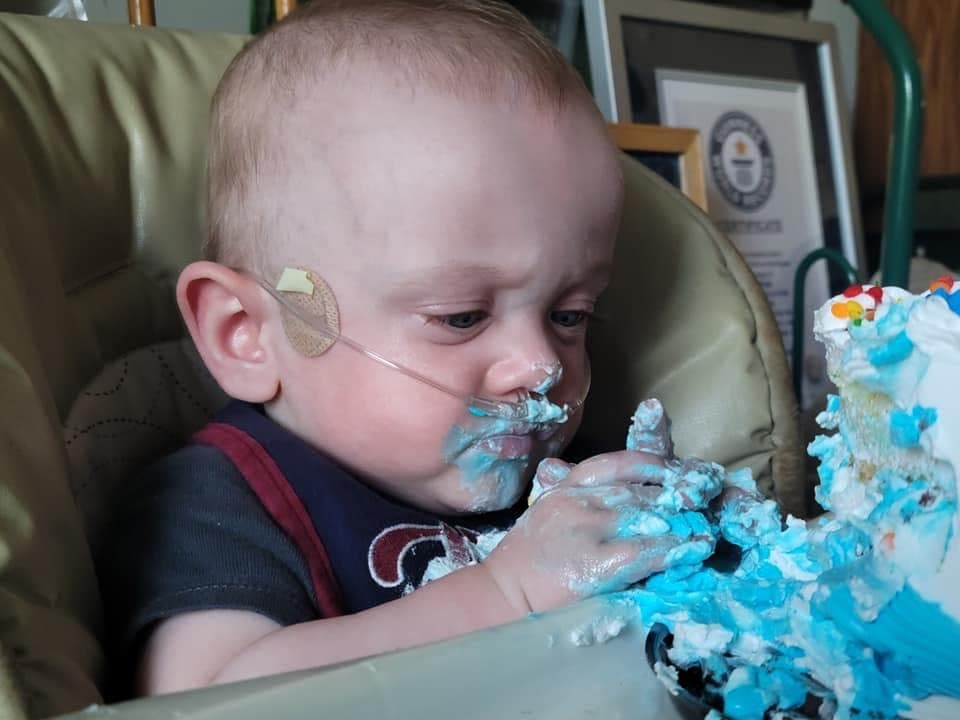 El de Hutchinson
<b> superó el récord que se mantuvo durante tres décadas y media</b> de James Elgin Gill, quien nació en Ottawa, Ontario, Canadá, a una edad gestacional de 21 semanas 5 días, o 128 días prematuros, el 20 de mayo de 1987.