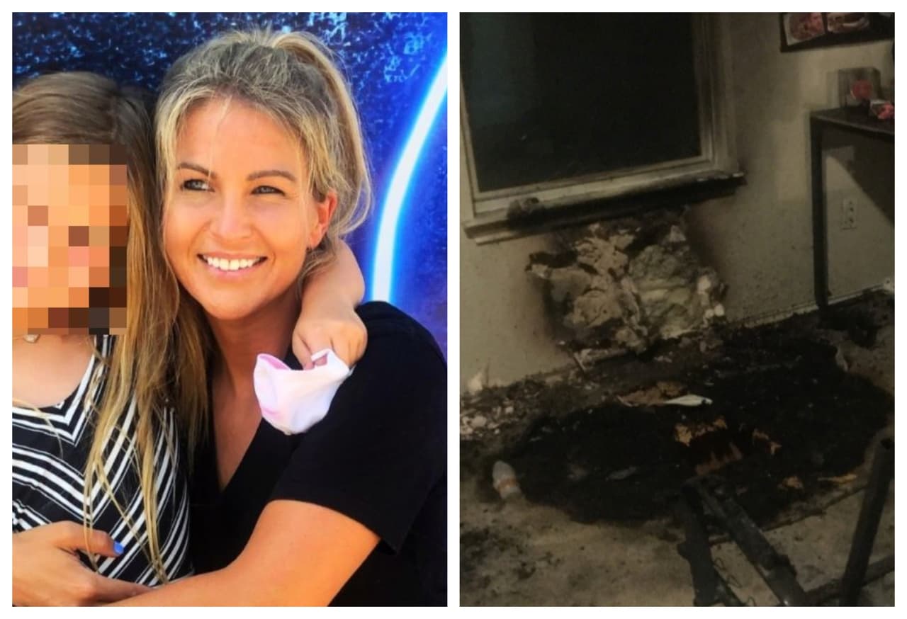 Mujer de Texas sufre graves quemaduras y asegura que fue a causa del desinfectante de manos