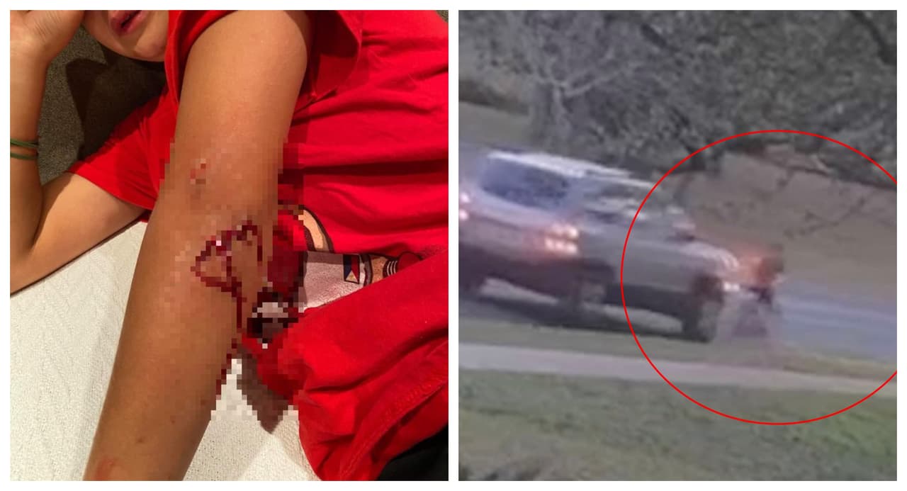 Policía de Austin busca a conductora que golpeó a un niño de 10 años y luego huyó de la escena