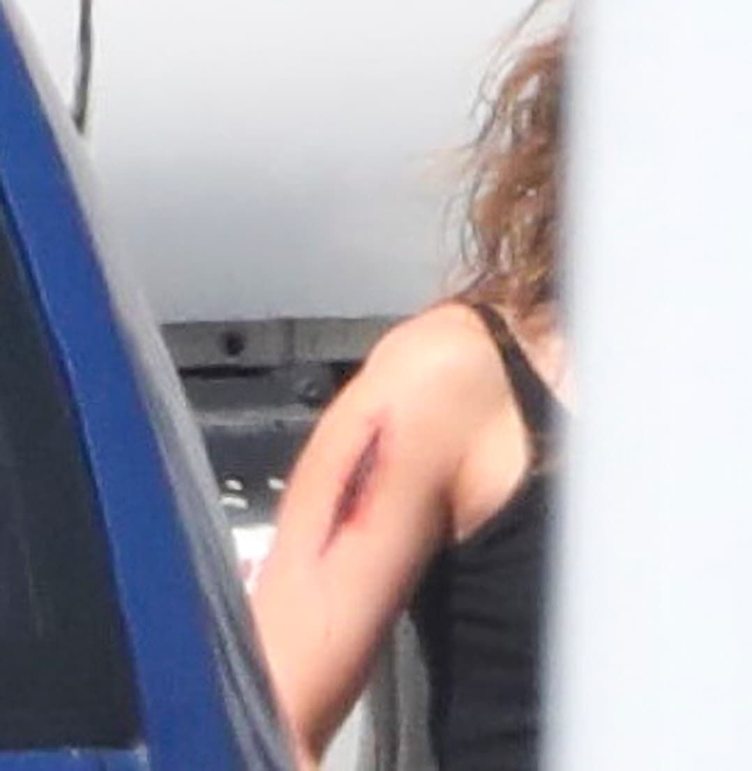 Aunque la lesión parecía demasiado real, se trataba de maquillaje, de acuerdo con el Daily Mail. 
<br>