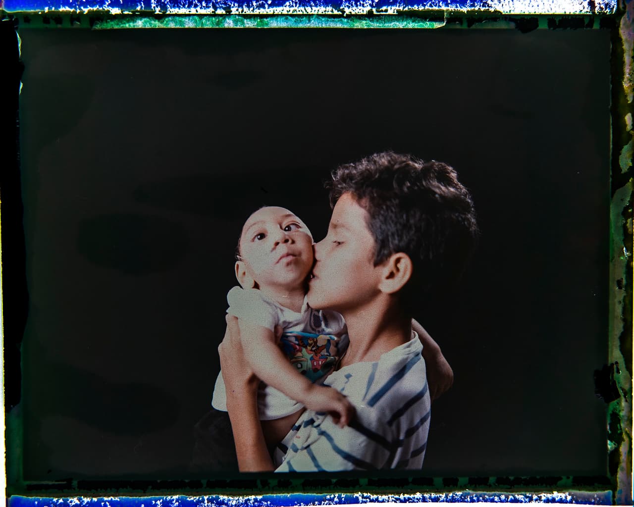 Elisson Campos carga con ternura a su hermanito de un año, Jose Wesley Campos. A él le encanta sostenerlo entre sus brazos y es muy cariñoso con el pequeño que no tuvo la suerte de nacer sano. Su madre contrajo zika. Aunque la causa de transmisión más frecuente es a través de la picadura de un mosquito, se ha determinado que también es posible que se contagie por la vía 
<a href="http://www.univision.com/noticias/virus-del-zika/lo-que-no-sabias-sobre-la-transmision-sexual-del-zika"><u>sexual</u></a>.