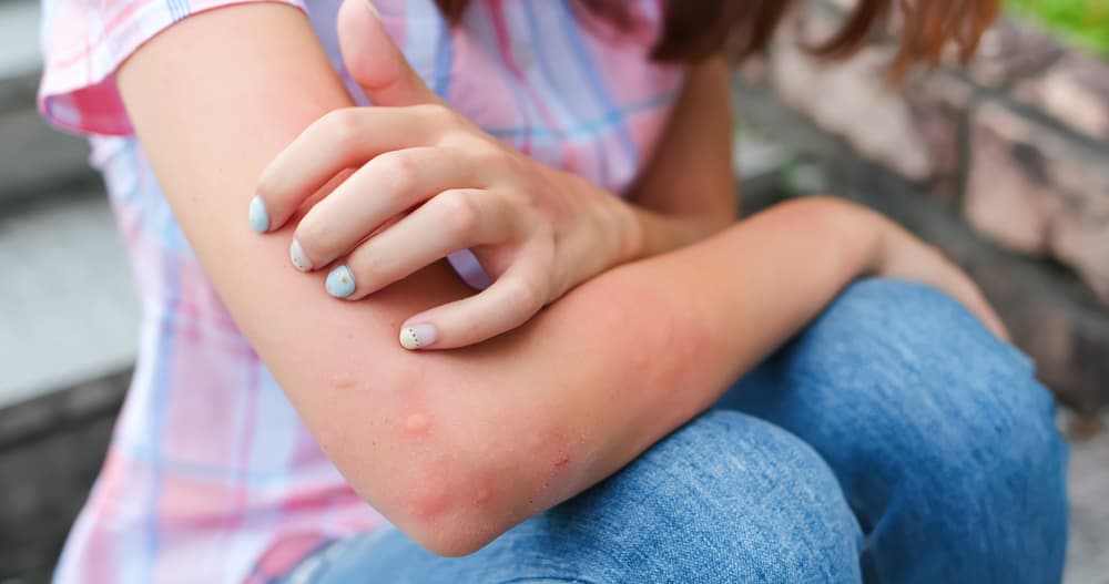 <h3 class="cms-H3-H3">Soñar que una araña te pica </h3>
<br>Esto suele interpretarse como que probablemente te sientes paralizado por el miedo, que te sientes inseguro o que tienes muchas dudas.