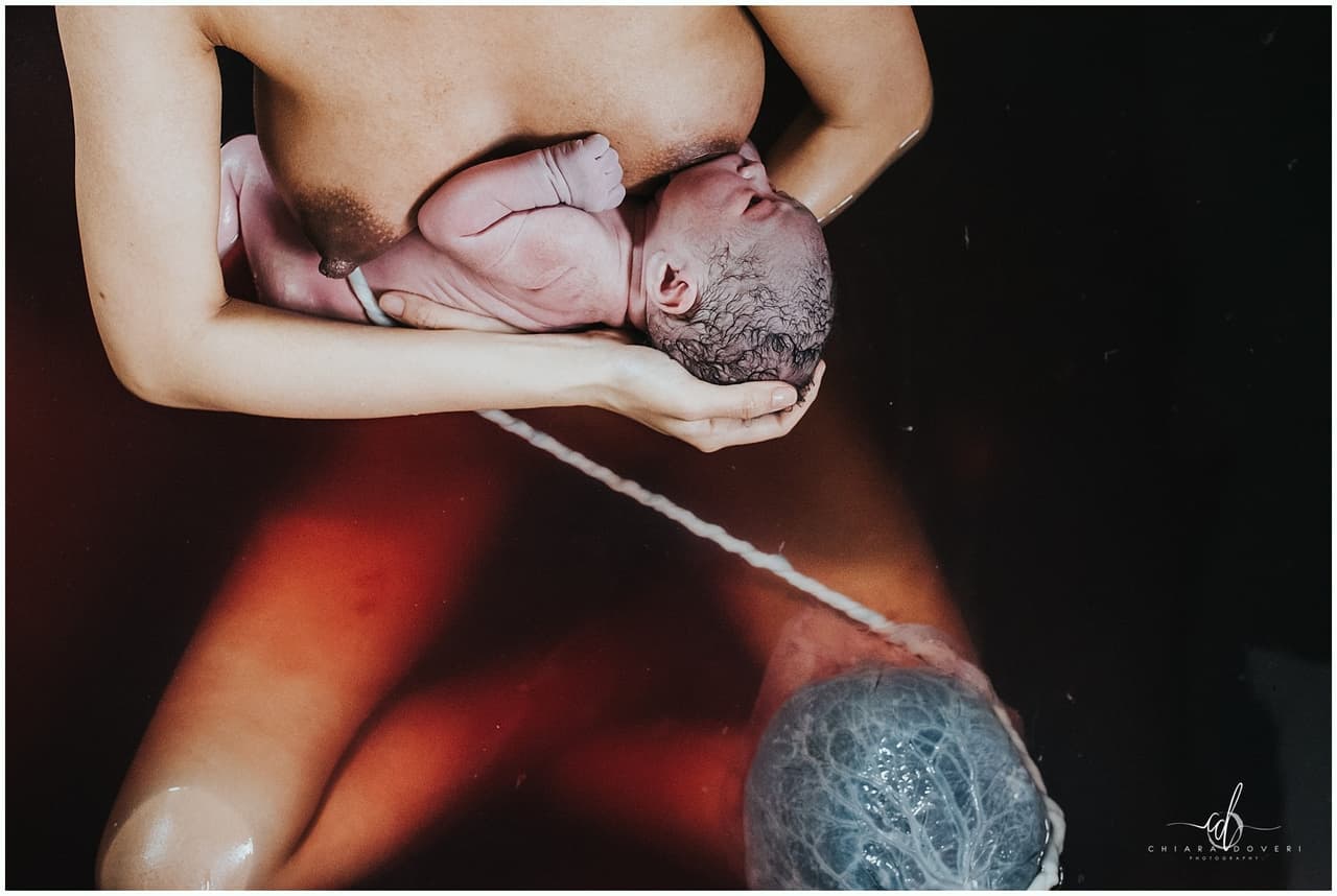 El cordón umbilical y la placenta quedaron retratados de manera vívida en esta imagen tomada por 
<a href="https://www.chiaradoveri.com/" target="_blank">Chiara Doveri Photography </a>que ocupó el tercer puesto en la categoría de color.
