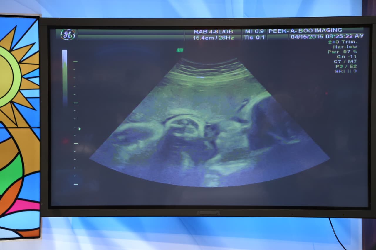 ¡Qué bello! ¿Lo ven?