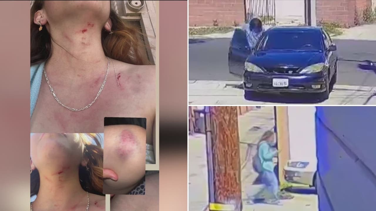 “Me la querían secuestrar”: adolescente hispana de 16 años escapa tras ser golpeada y robada por tres hombres