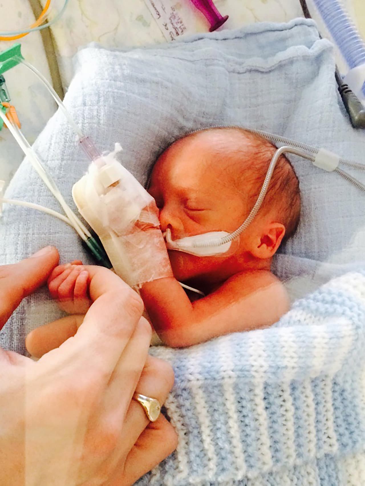 La pareja decidió que la cirugía se llevara a cabo, a pesar de todos los riesgos prefirieron darle una oportunidad a sus hijos.