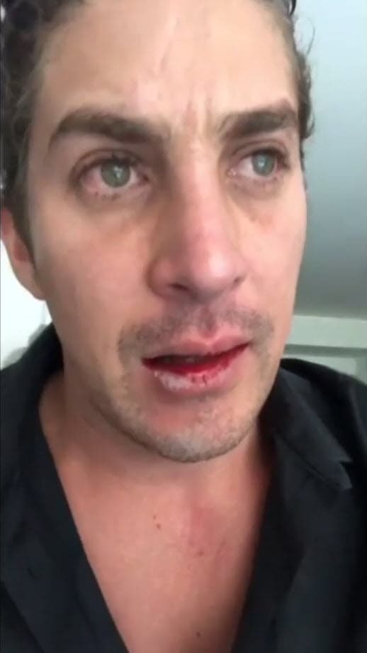 Al principio, Jonathan asegura que lo habían agredido sin dar nombres: "Estaba yo durmiendo aquí y 
<b>estaba drogada y tomada, y me rompió la boca</b>. ¿Pueden venir por mi? Gracias".