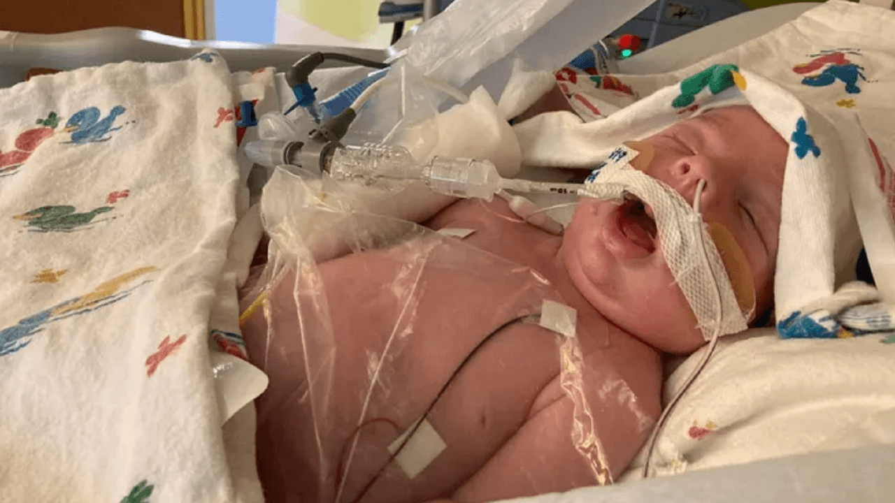 Bebé recién nacido murió por un virus que le ocasionó daño cerebral: alertan que se ha reportado en "varios estados"