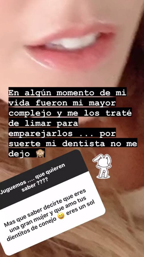 Hablando de sus complejos, recordó que en una etapa de su vida 
<b>sus dientes no le gustaban.</b>