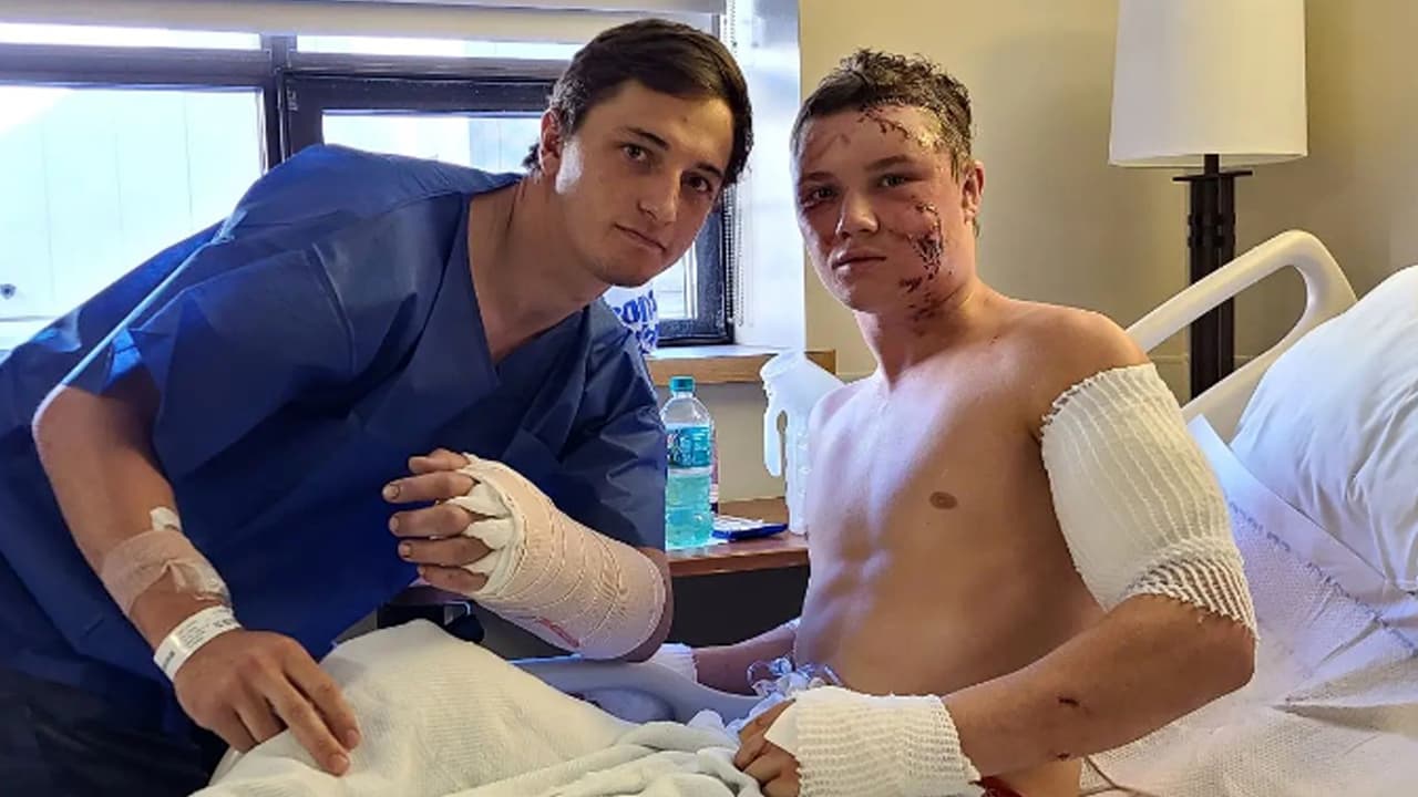 Brady tiene un brazo fracturado y fuertes heridas en el muslo, requirió seis tornillos y pernos.