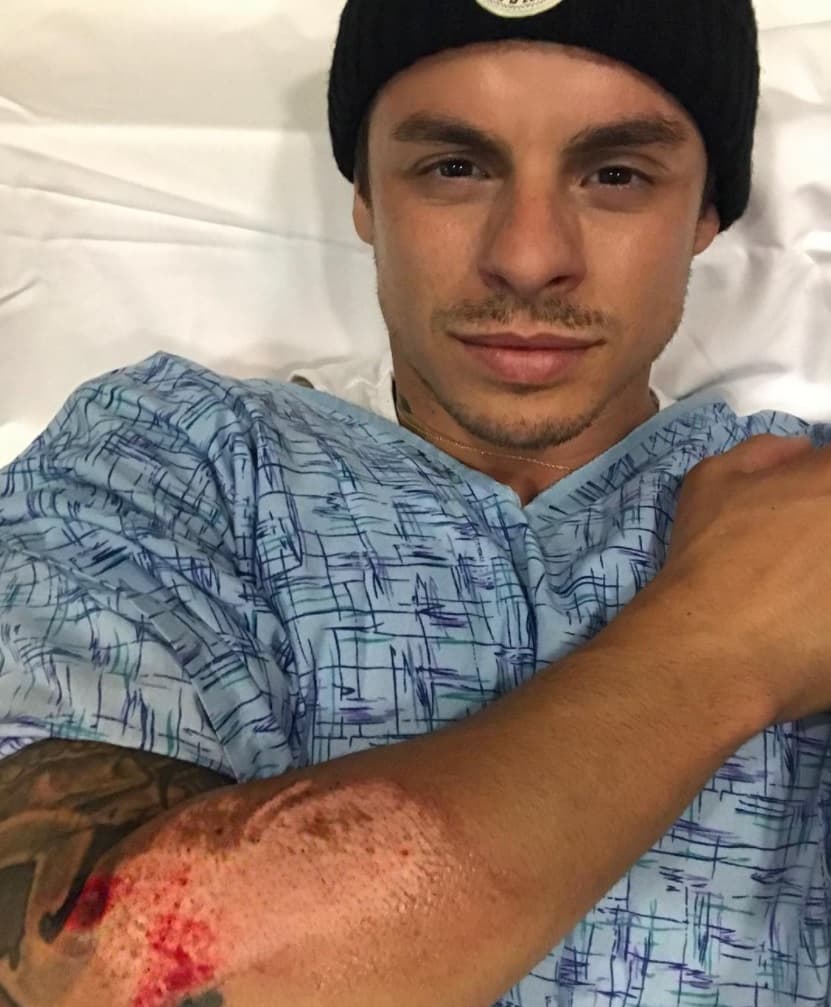 El bailarín y coreógrafo posteó una foto con el brazo derecho lastimado, a consecuencia de un accidente en motocicleta que tuvo el 22 de junio.