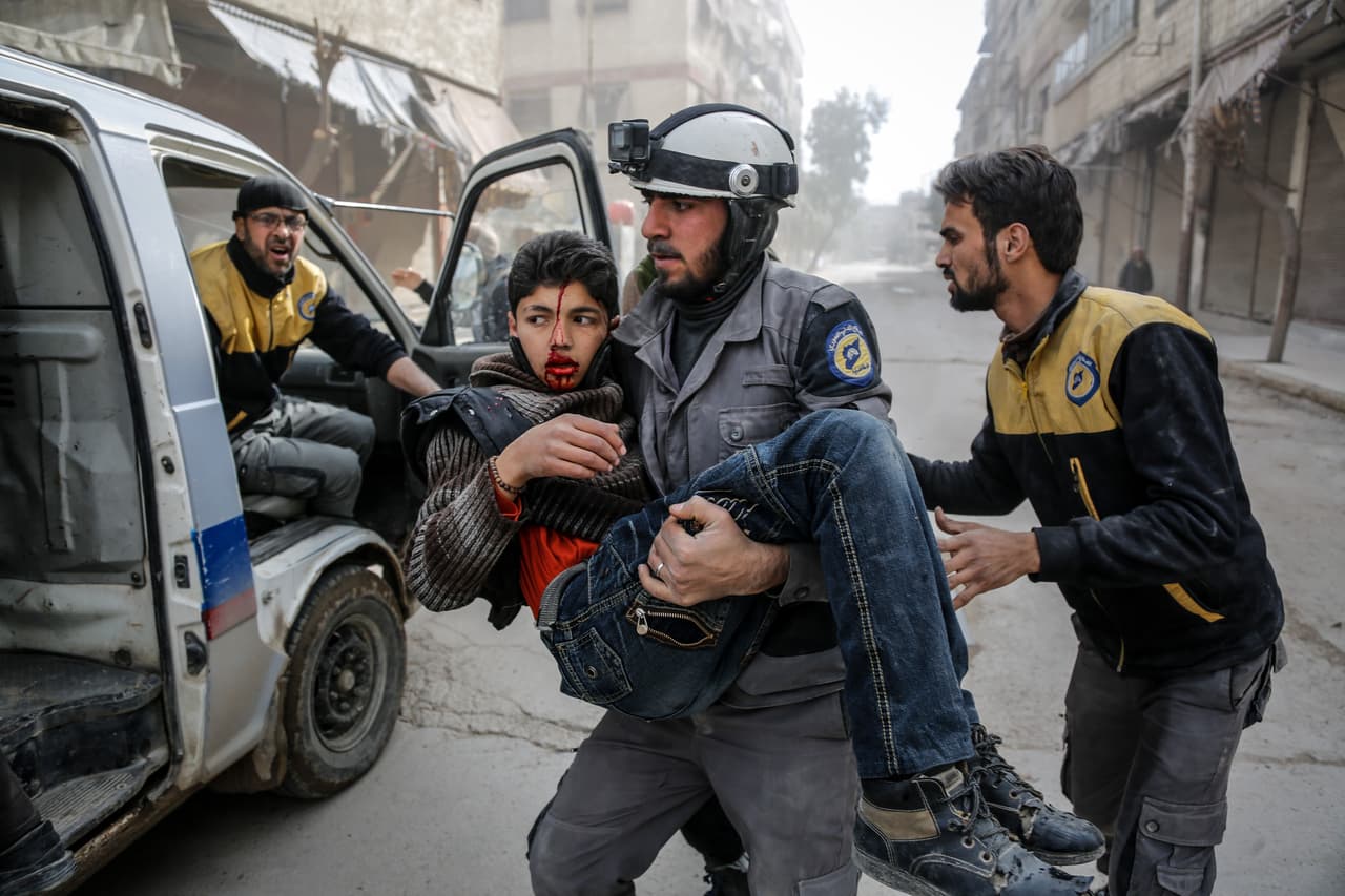 Otro niño sobreviviente del bombardeo del 20 de febrero en Sakba, Guta Oriental. Según el Observatorio Sirio para los Derechos Humanos, cerca de 20.000 hombres, mujeres y niños han logrado escapar a través de un corredor habilitado para llegar a las zonas bajo control del Gobierno.