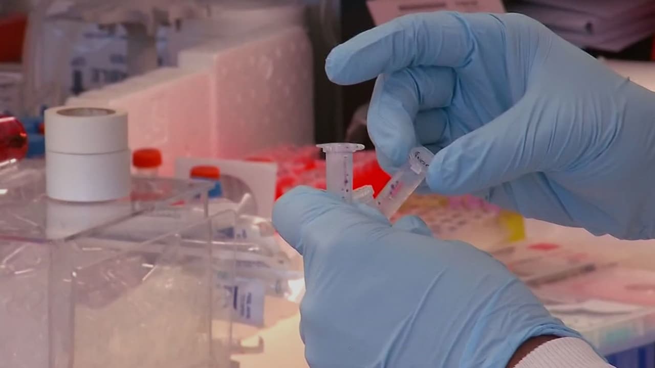 IA detecta cáncer de páncreas hasta tres años antes, revela estudio de Clínica Mayo