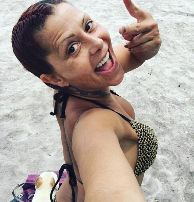 Tras haberse sometido a un procedimiento, aplicado por Valentina de Albornoz, la cantante ha permanecido bajo tratamiento, debido a que se le infectó la zona aplicada, así como la sangre y parte del hueso, de acuerdo con información de El Universal.