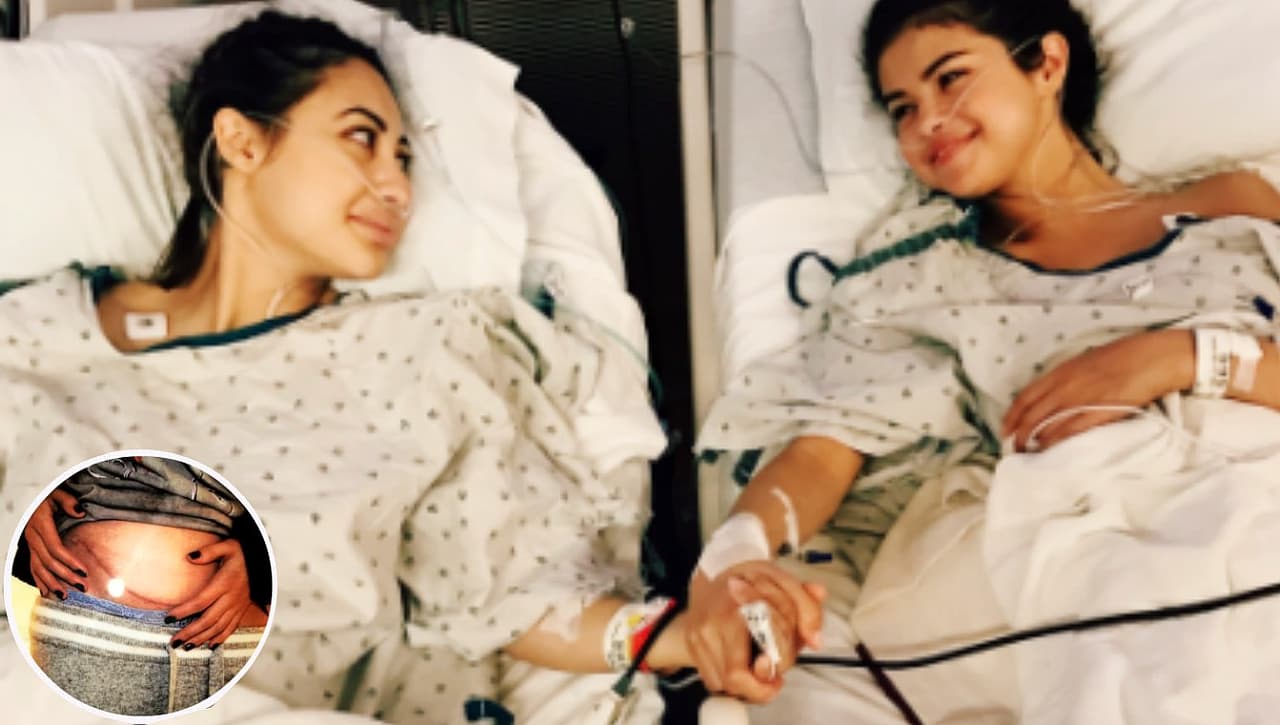 Selena Gómez recibió un trasplante de riñón de su mejor amiga