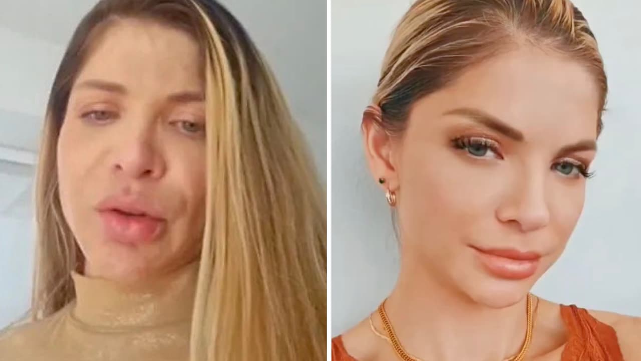 Famosa modelo y actriz colombiana conmociona en un ‘live’: “Llevo dos años consumiendo” 