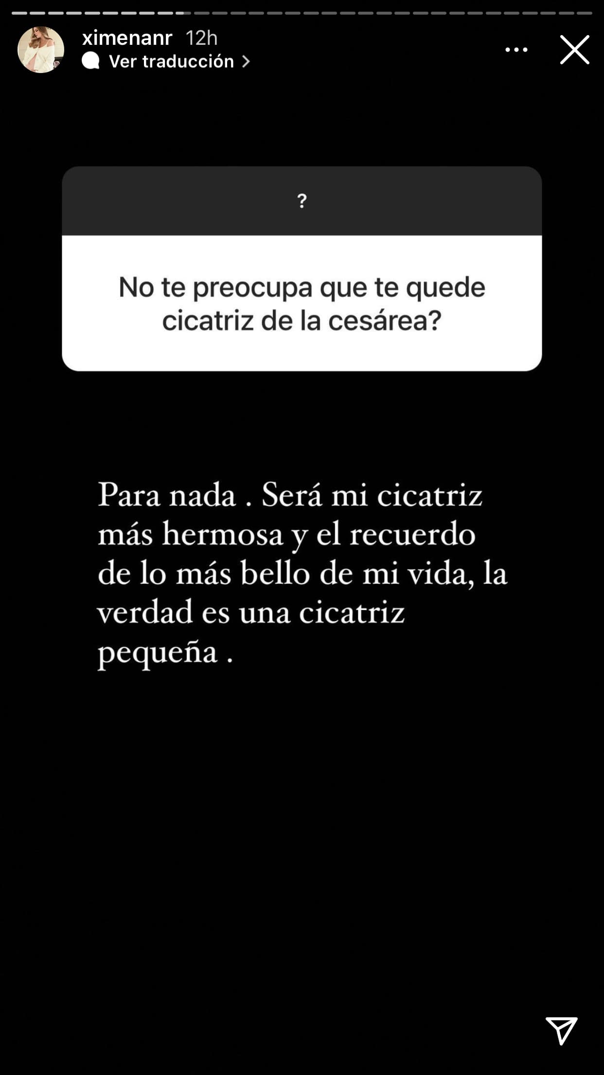Otro seguidor le cuestionó si le preocupaba que le quede cicatriz tras la cesárea: "Para nada. 
<b>Será mi cicatriz más hermosa</b>", contestó. 
<br>
