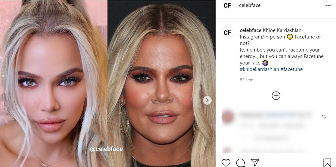 En noviembre de 2019, Khloé Kardashian fue expuesta por la cuenta de Instagram Celebface que suele exhibir la edición de fotos engañosas por parte de algunas celebridades. En ese entonces, divulgó una comparativa entre dos fotos en las que trataban de evidenciar que la empresaria se había hecho
<b><a href="https://www.instagram.com/p/B40nsW3HTsn/?utm_source=ig_embed" target="_blank">algún arreglo de edición en la nariz</a></b> para lucirla más estilizada.
<br>
