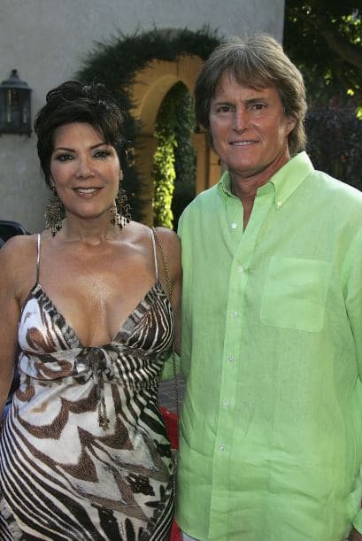 Varias cirugías fueron transformando su rostro.