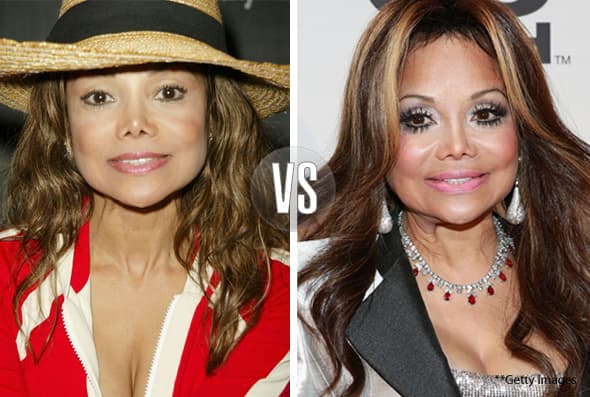 LaToya Jackson, hermana del 'rey del Pop' también es fan del bisturí.